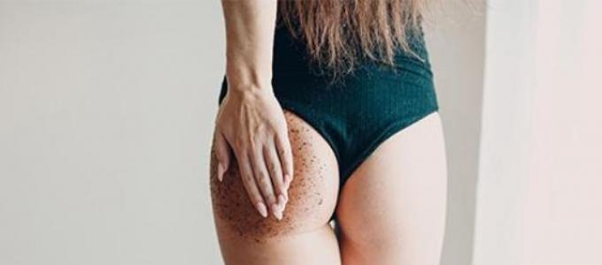 Why there are pimples on the butt - causes and treatment: how to get rid of and why red pimples and rashes appear in women
